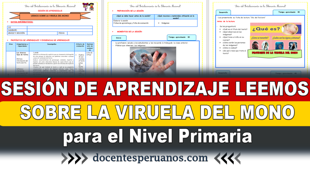 SESIÓN DE APRENDIZAJE LEEMOS SOBRE LA VIRUELA DEL MONO para el Nivel Primaria